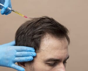 PRP Hair Regrowth Treatment