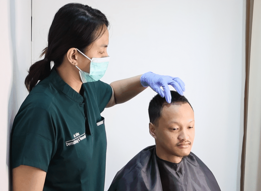 Layanan Hair Transplant di Tanam Rambut Indonesia, Jakarta Selatan