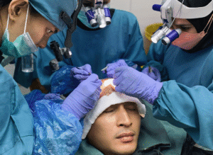 Layanan Scar Revision di Tanam Rambut Indonesia, Jakarta Selatan